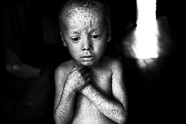 PABLO E. PIOVANO: THE HUMAN COSTOF AGROTOXINS